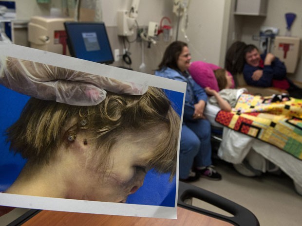 Menina teve orelha arrancada quando era bebê após ser atacada por guaxinim (Foto: Chris Clark/The Grand Rapids Press/AP) Menina teve orelha arrancada quando era bebê após ser atacada por guaxinim (Foto: Chris Clark/The Grand Rapids Press/AP)