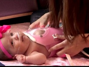 Um bebê que nasceu com parte do coração batendo fora do corpo deixou o hospital (Foto: BBC)