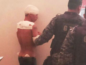 Vítima levou pauladas na cabeça e chutes pelo corpo (Foto: Arquivo Pessoal) Vítima levou pauladas na cabeça e chutes pelo corpo (Foto: Arquivo Pessoal)
