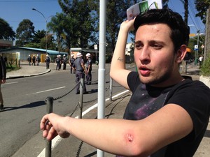 Estudante conta que caiu durante correria em confronto com a polícia (Foto: Darlan Alvarenga/G1)