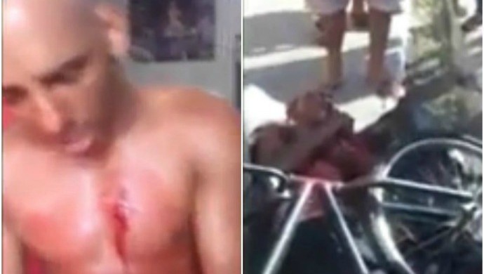 Em Fortaleza, Boxeador foi ferido no peito e no braço com golpes de faca (esquerda); à direita, assaltante foi agredido até desmaiar (Foto: Flávio Leal/Arquivo pessoal) Em Fortaleza, Boxeador foi ferido no peito e no braço com golpes de faca (esquerda); à direita, assaltante foi agredido até desmaiar (Foto: Flávio Leal/Arquivo pessoal)