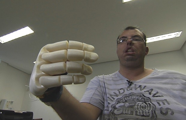 Prótese 3D criada na UFG é 30 vezes mais barata que produtos similares em Goiás (Foto: Reprodução/TV Anhanguera)