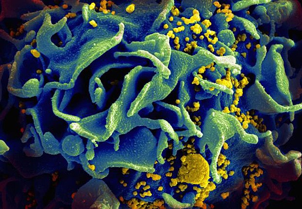 Imagem de microscópio mostra superfície de célula do sistema imune infectada por HIV (Foto: NIAID/NIH)