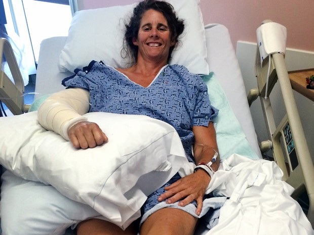 Maria Korcsmaros, que é triatleta, foi atacada enquanto nadava em praia de Corona del Mar (Foto: Alex Korcsmaros/Orange County Global Medical Center/AP)