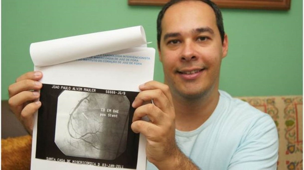 João Paulo Mauler mostra exame após coração operado; infarto foi 'divisor de águas' profissional, afirma ele  (Foto: Lara Toledo/BBC Brasil)