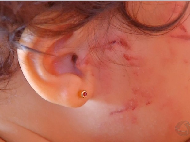 Criança de 2 anos teria mordido e agredido bebê de 11 meses em berçário de Rondonópolis (Foto: Reprodução/TVCA)