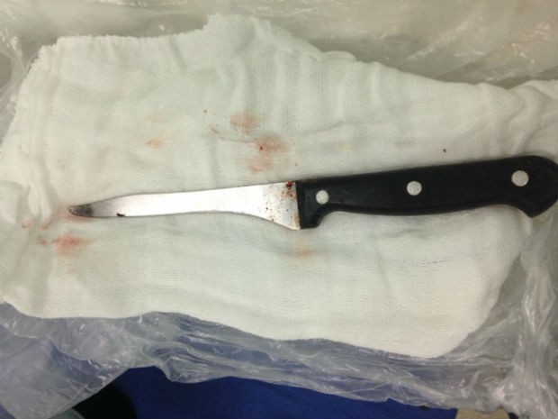Cirurgia retirou faca de quase 15 centímetros da cabeça de trabalhador (Foto: TEM VC/Divulgação)