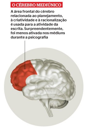 Cérebro mediúnico (Foto: Reprodução/Revista ÉPOCA)