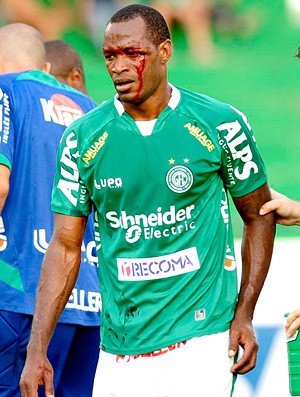 fabão ensaguentado, guarani x corinthians (Foto: Marcos Ribolli / Globoesporte.com)