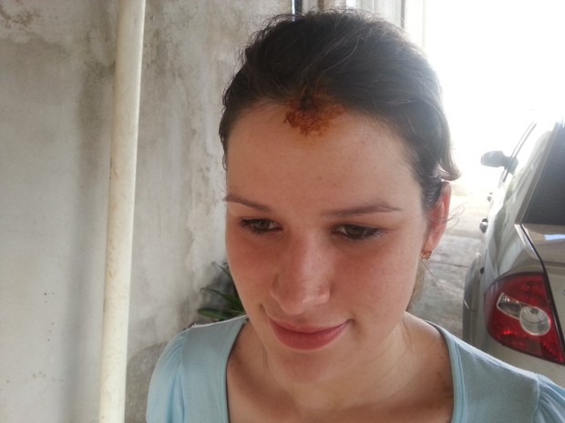 Soldado Liliane se recupera em casa após ser atingida por uma pedra na cabeça (Foto: Thais Pucci/G1)
