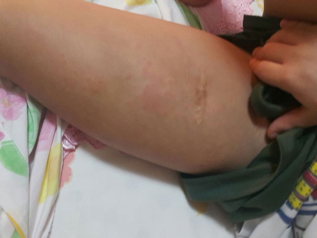 Menino de sete anos com doença rara foi internado em Salvador (Foto: Elcimar Badu/Arquivo pessoal)