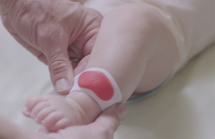 Sproutling é um sensor que se prende no tornozelo do bebê para monitar sua saúde (Foto: Divulgação/Sproutling)