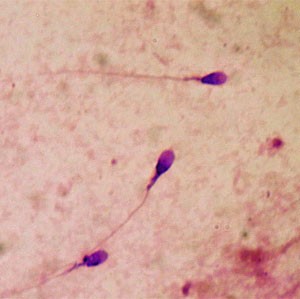 Espermatozoides fotografados ao microscópio. (Foto: Bobjgalindo/Creative Commons)