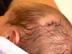 Ferimento na cabeça do bebê em Itabuna, na Bahia (Foto: Reprodução/TV Santa Cruz)