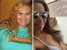 Solange Almeida mostra antes e depois de perder 55 quilos