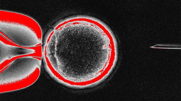 Óvulo de doadora com núcleo de célula de pele (Foto: Divulgação/OHSU)