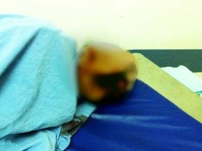 Idoso Com Cancer Fica Dois Dias Com Larvas No Rosto Em Hospital De Al Alagoas G1 Escovas de dentes com cerdas mais rijas: g1 globo com