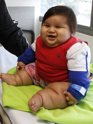 Santiago Mendoza em uma clínica de Bogotá, na Colômbia, nesta terça-feira (18). O bebê de oito meses pesa mais de 20 quilos e passará por uma dieta  (Foto: AP Photo/Fernando Vergara)