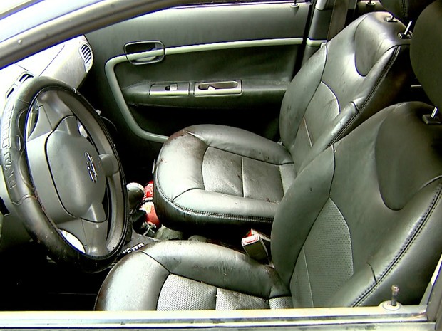 Motorista do Uber foi atingido por disparos na cabeça e nas pernas (Foto: Reprodução/EPTV) Motorista do Uber foi atingido por disparos na cabeça e nas pernas (Foto: Reprodução/EPTV)