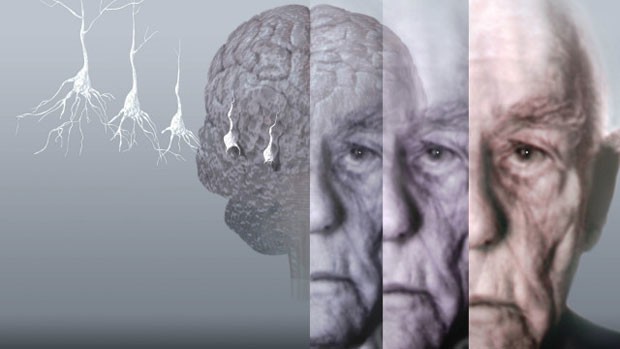 Alzheimer está entre as doenças cuja predisposição pode ser indicada através de testes de DNA (Foto: SPL/BBC)