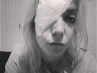 Luiza Possi posta foto com curativo no olho e fã diz: 'Espero que melhore'