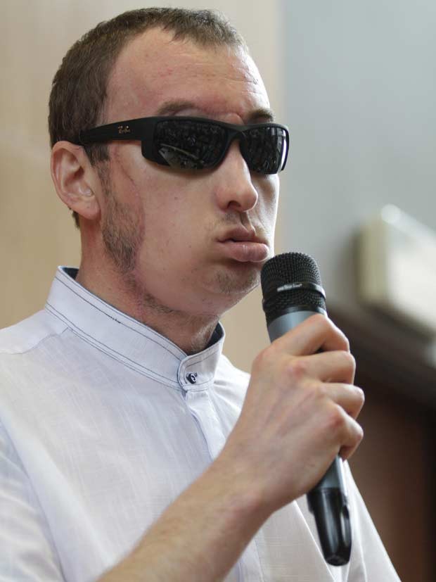 Primeiro homem a receber transplante de face na Polônia tem alta. (Foto: AFP Photo/Bartek Wrzesniowski)