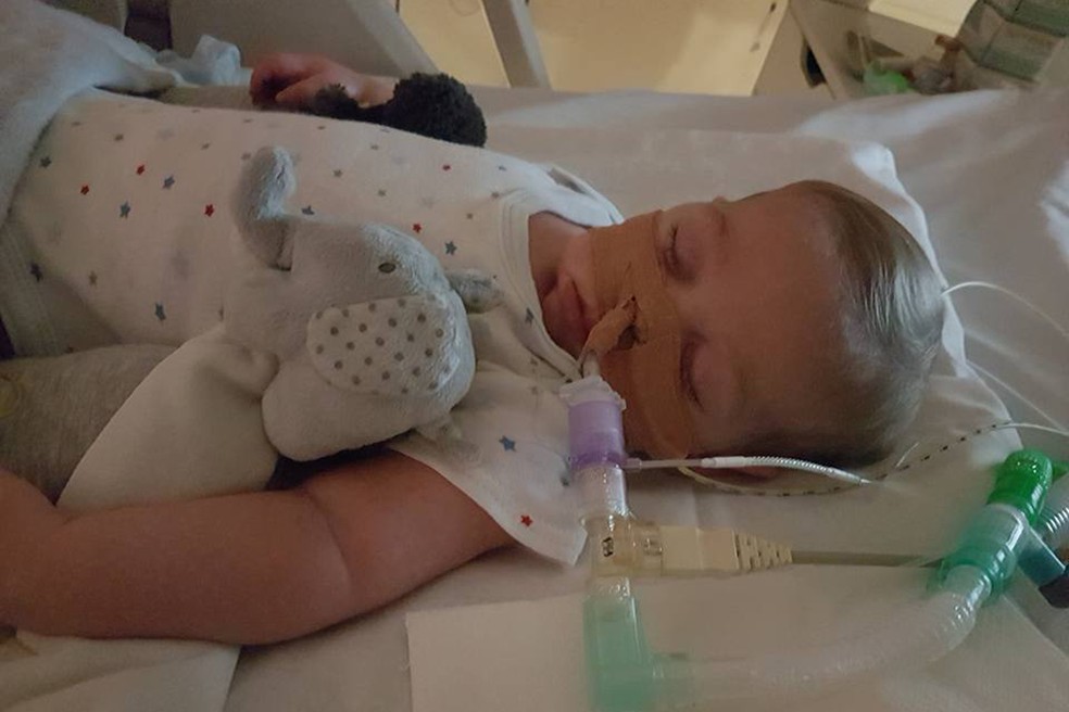  Doença causou surdez e impossibilita Charlie de chorar  (Foto: Reprodução/Facebook/Connie Yates)