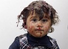 Menina sobrevive a ataque na Síria (Hosam Katan/Reuters)