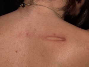 Menina ficou ferida após agressão (Foto: Reprodução / TV TEM)
