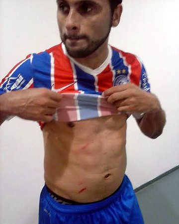Maxi Biancucchi mostra ferida causada por Gil, zagueiro do Corinthians (Foto: Divulgação/E.C. Bahia)