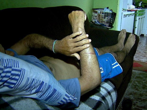 Homem de 55 anos, vítima de atropelamento, mostra ferimentos no corpo (Foto: Reprodução/EPTV) Homem de 55 anos, vítima de atropelamento, mostra ferimentos no corpo (Foto: Reprodução/EPTV)