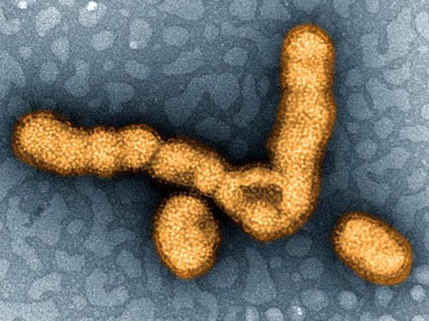  Imagem de micrografia eletrônica de transmissão colorida digitalmente mostra agrupamento de partículas de H1N1  (Foto: National Institute of Allergy and Infectious Diseases (NIAID))