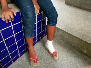 Adolescente de 17 anos torceu o pé após atropelamento (Foto: Robel Sousa/TV Bahia)