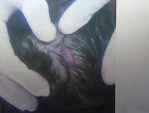 Gerente foi ferido na cabeça após tentar socorrer colega (Foto: Reprodução / TV tapajós)