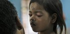 Duas crianças saem vivas de tragédia indiana (Rajanish Kakade/AP)