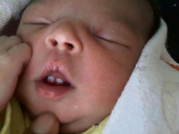 Bebê nasce com dois dentes em Colatina, Espírito Santo (Foto: Arquivo Pessoal)