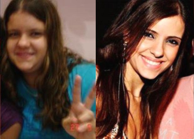 Antes e depois da jovem Ana Carolina Moraes, de 20 anos (Foto: (Foto: Arquivo Pessoal / Ana Carolina Moraes))