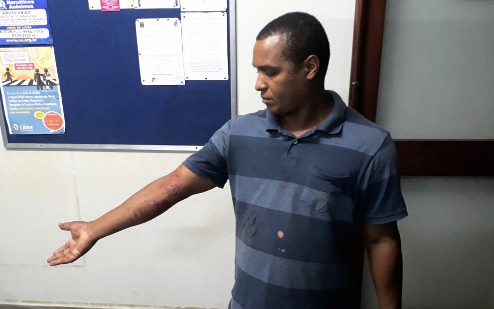 Daniel fica ferido ao quebrar o vidro da janela do carro (Foto: Paula Resende/G1)