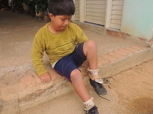 Após cirurgia, menino que tinha 26 dedos comemora poder jogar bola em Abadia de Goiás 2 (Foto: Sílvio Túlio/G1)