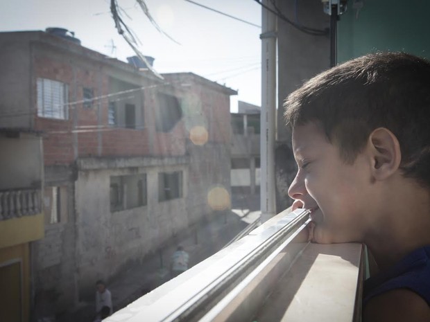 Kauã Soares Oliveira, de 7 anos, não tem as glândulas do corpo necessárias para transpirar (Foto: Caio Kenji/G1)