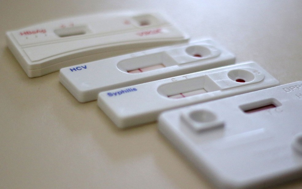 kits para exames rápidos de DST/AIDS (Foto: André Borges/Agência Brasília)