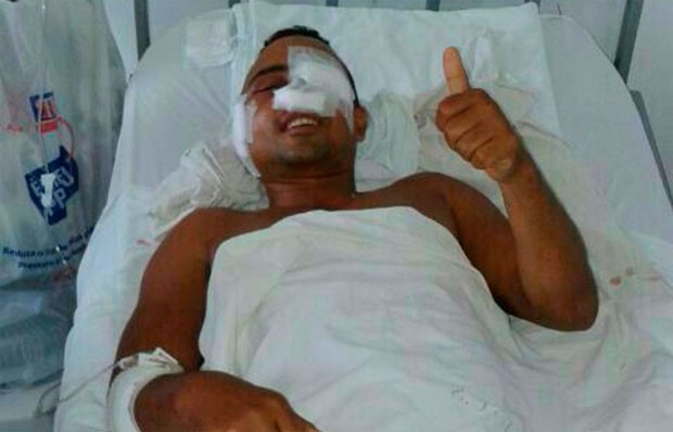 Soldado Anderson Ferreira perdeu visão do olho esquerdo (Foto: Divulgação/Polícia Militar do RN)