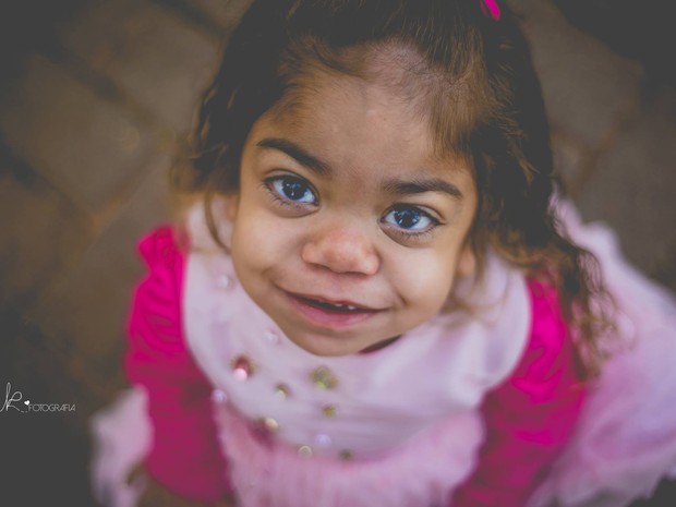 Yasmin dos Santos Moraes foi diagnosticada com síndrome de Hurler (Foto: Divulgação/WK Fotografia)