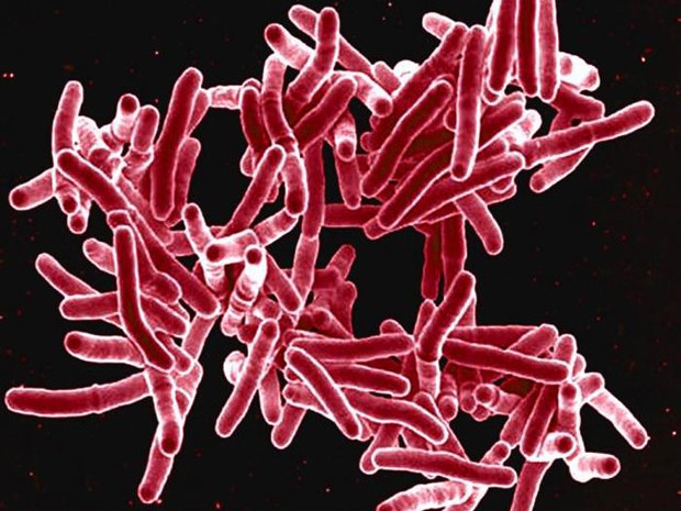   Imagem de microscopia eletrônica  mostra a bactéria Mycobacterium tuberculosis, que provocam tuberculose  (Foto: National Institute of Allergy and Infectious Diseases (NIAID))