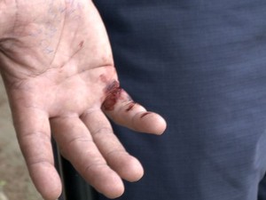Um dos agentes teve as mãos feridas pelo motociclista, no Espírito Santo (Foto: Reprodução/TV Gazeta)