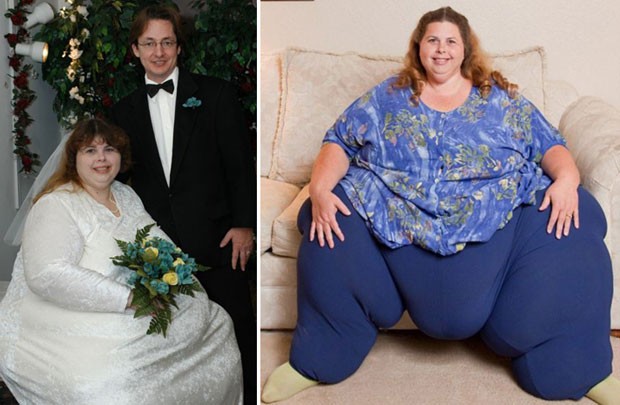 * Essa é a dieta: Mulher mais gorda do mundo perde 50 kg graças a 'maratona de sexo', diz.