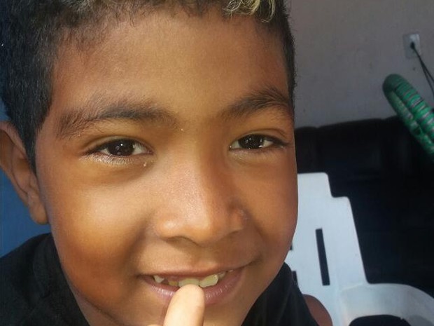 Menino de 7 anos perdeu a orelha após ser atacado por pit bulls, diz mãe (Foto: Edineia Arruda/Arquivo Pessoal)