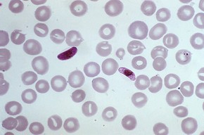 malária paraziták)