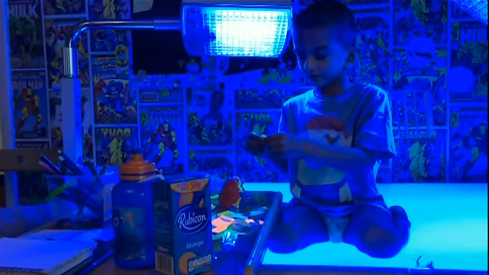 Menino sofre de uma doença raríssima – a síndrome de Crigler-Najjar -, uma condição genética caracterizada pela incapacidade do corpo de converter e eliminar do sangue a bilirrubina (Foto: BBC)