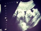 Aryane Steinkopf mostra ultrassonografia do filho, Aarão